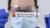 SAD proglasile vanrednu zdravstvenu situaciju zbog majmunskih boginja