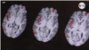 Los efectos de la luz solar en el cerebro
