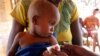 FILE - A child's arm is measured at a center set up by World Food Programme and Action Against Hunger, in the village of Beraketa, in the far south of Madagascar. Nov. 12, 2020. 